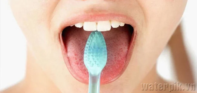 vệ sinh răng sau khi implant